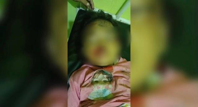 Usai Bocah Tewas, BBKSDA Riau Imbau Warga Menanam Tanaman Ini di Lintasan Gajah