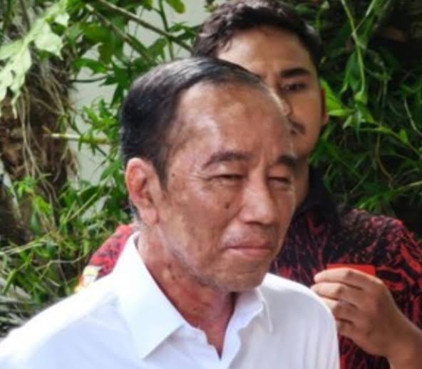 Pulang dari Vatikan, Jokowi Alami Sakit Kulit dan Peradangan