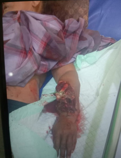 Seorang Suami Berjibaku Melawan Buaya Saat Istrinya Diseret ke Tengah Sungai